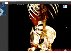 ORPALIS DICOM Viewer Screenshot 1