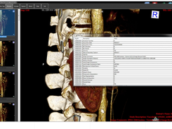 ORPALIS DICOM Viewer Screenshot 1