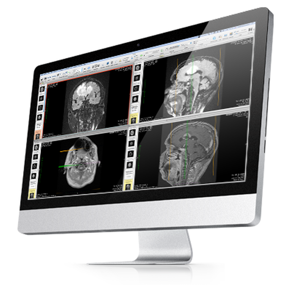 OsiriX Screenshot 1