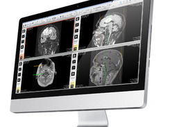 OsiriX Screenshot 1