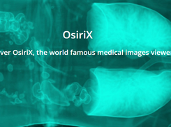 Osirix Screenshot 2