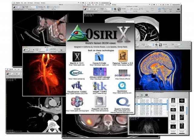 osirix download mac osirix download mac