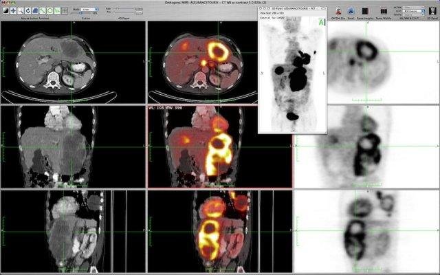 Osirix free download for mac