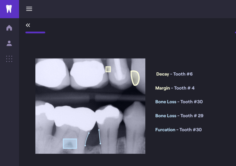 Overjet Screenshot 1