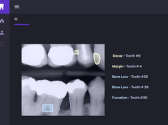 Overjet Screenshot 1