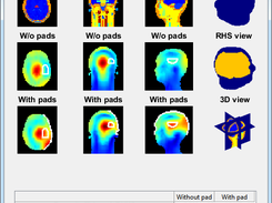 Optimization results for a certain region of interest (ROI)