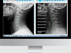PostureRay Screenshot 1