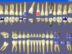 Practice-Web Dental-3DmovementChart