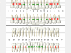 Practice-Web Graphical Perio Chart