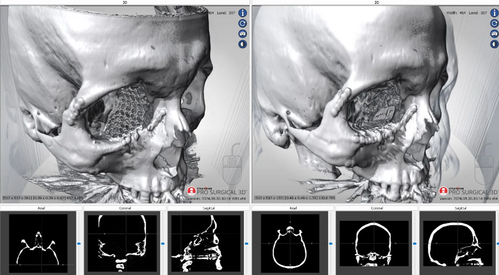 Pro Surgical 3D Screenshot 1
