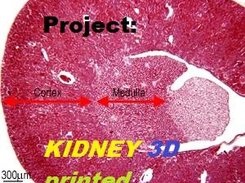 Project Kidney 3d Printed Logo