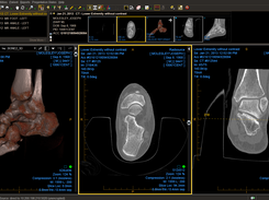 Ankle CT demonstrating viewer capability