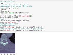 Pydicom by examples Screenshot 1