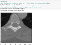 Pydicom by examples Screenshot 2