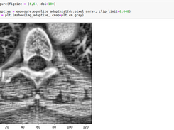 Pydicom by examples Screenshot 4