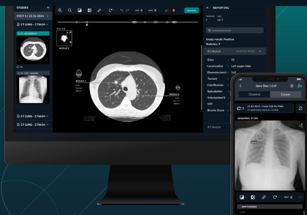 qCT Screenshot 1