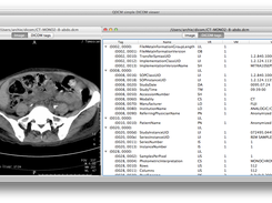 Simple DICOM viewer