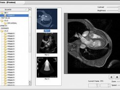 full functional dvd / cd dicom browser