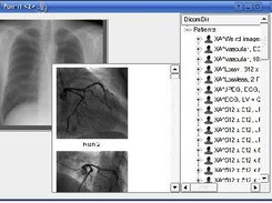 patient list / image viewer widgets