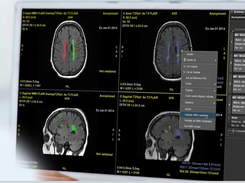 Quantib Brain Screenshot 1