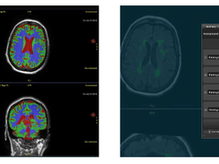 Quantib Brain Screenshot 2