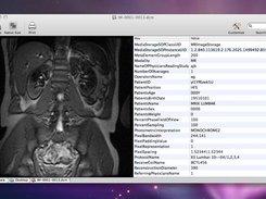 Quick Dicom Analyzer Example Project