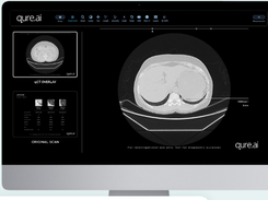 Qure.ai Screenshot 1