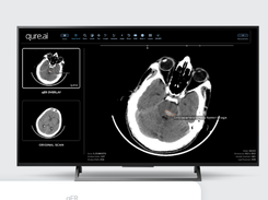 Qure.ai Screenshot 1