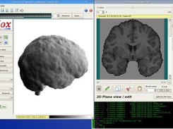 Surface and slice view of a brain