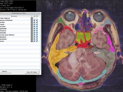 Masks with browser view (here skull osteology)