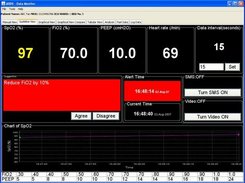 ARDS Guiline view (auto monitoring view)