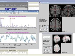 Power Spectrum with Slice Viewer