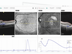 RetinAI Screenshot 1