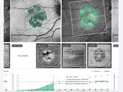 RetinAI Screenshot 5