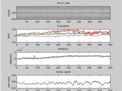 DIsplay of incoming data and real-time motion assessment