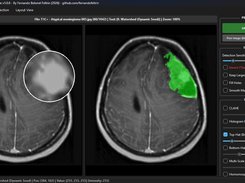 Medical Img Segmentation Suite Screenshot 1