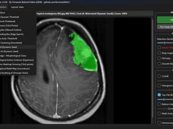 Medical Img Segmentation Suite Screenshot 2