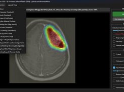 Medical Img Segmentation Suite Screenshot 3