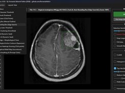 Medical Img Segmentation Suite Screenshot 4