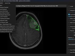 Medical Img Segmentation Suite Screenshot 5