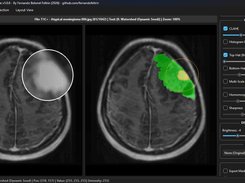 Medical Img Segmentation Suite Screenshot 6