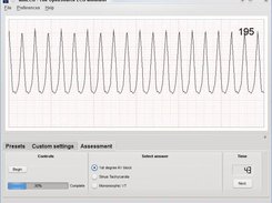 simECG V1.0 in Linux platform running an assessment