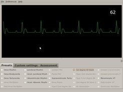 simECG v1.186 using monitor display colors