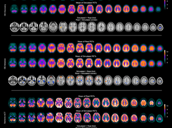 Comparison of real and simulated images for different scanners