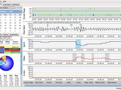 Allows Comparison of Oximetry with CPAP