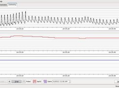 CMS50 Oximetry live recording mode.