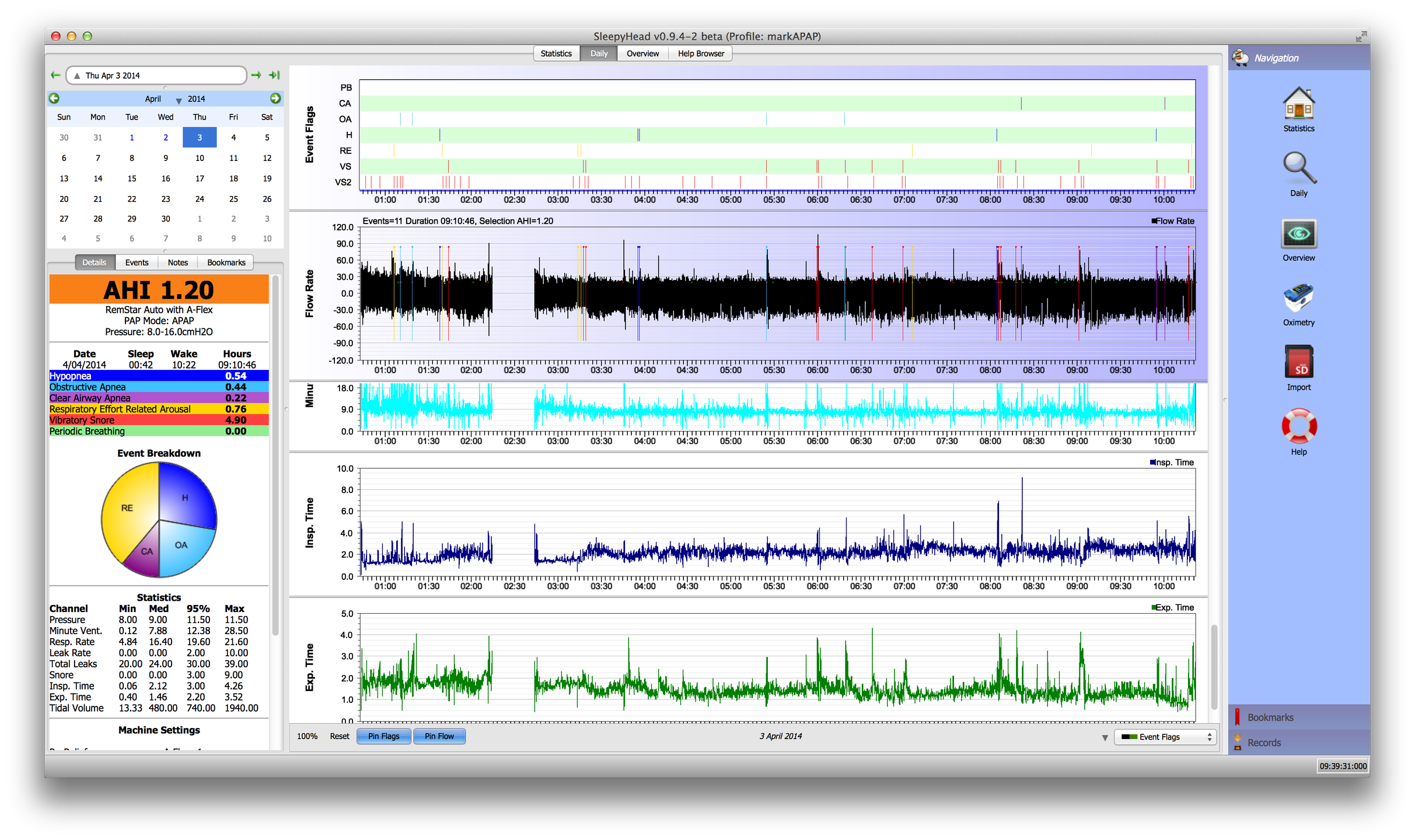 Sleepyhead Download Sourceforge Net