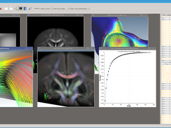 Deformation Fields, FODs and Shapes