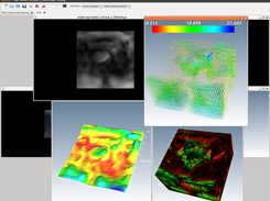 Deformation field visualisation