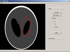 Initialisation of Snake Curve